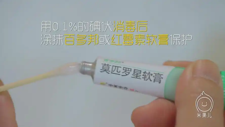 原创哺乳妈妈被宝宝咬破乳头怎么办