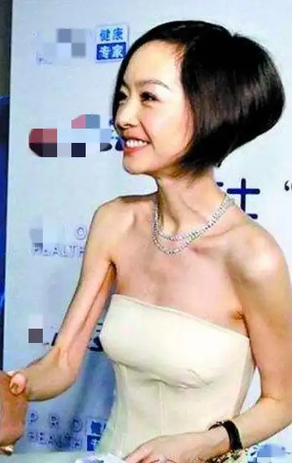 娱乐圈骨瘦如柴的女星赵丽颖郑爽上榜5