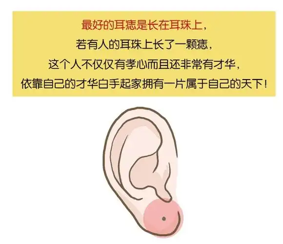 这几个地方长痣,聪明又有钱!千万不要点!