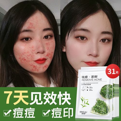 天然茶树补水面膜补水修复熬夜油性皮肤痘痘肌淡化痘印面膜贴 31片