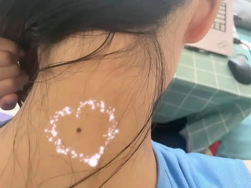 有苦情痣的来集合.