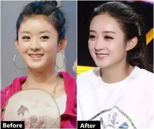 颖宝产后终现身,一个动作看他是否幸福_赵丽颖