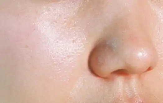 皮肤暗沉发黄,基本是这些原因造成,看看你有没有?