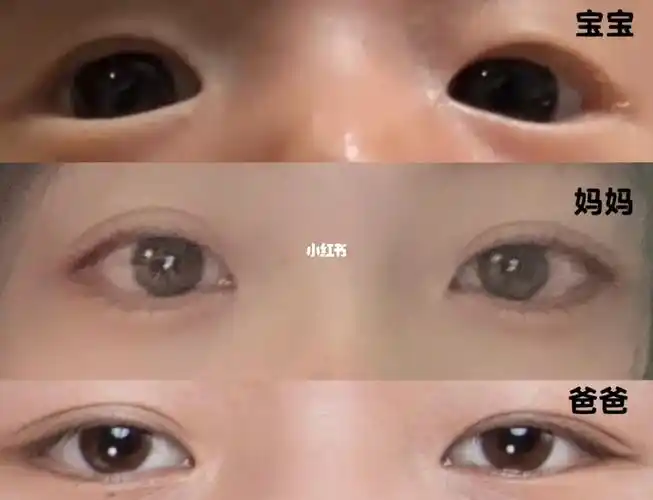 一个月了该不会是个单眼皮宝宝吧