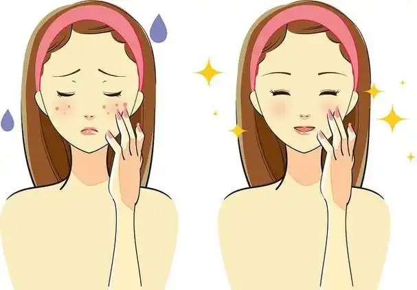 毛孔收缩对皮肤干燥有影响?你是否了解正确的毛孔收缩方式?