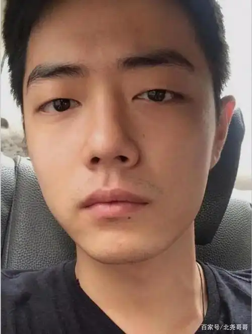 肖战原来是单眼皮当他晒出正脸自拍意外发现整容痕迹