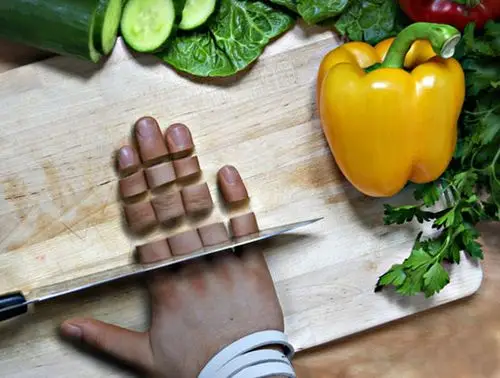 切菜不小心把手给切了