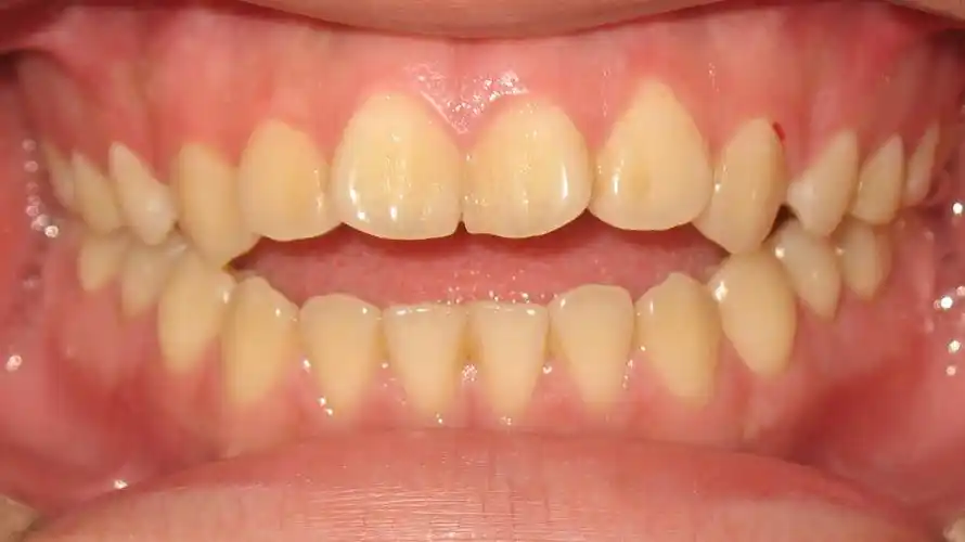 如疾病,口腔不良习惯,牙齿替换不正常等各种原因导致的牙齿,颌骨,颅面