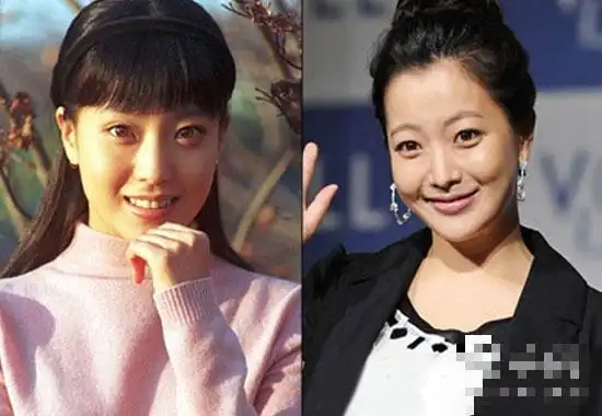 金喜善多年整容变不老女神