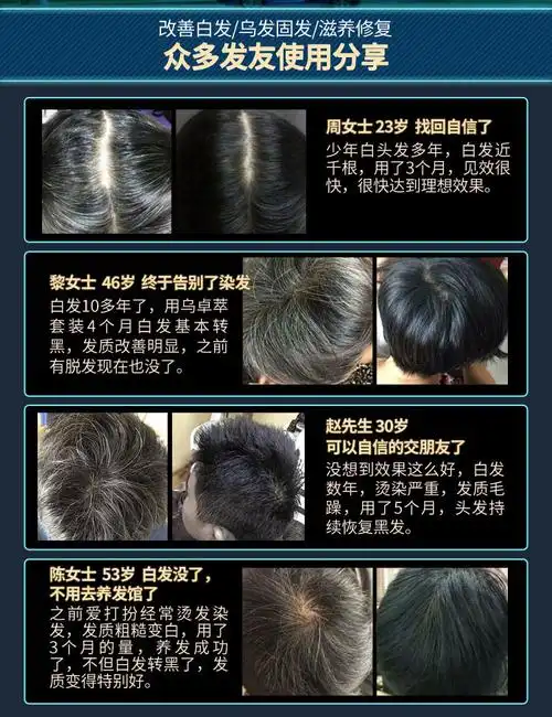 乌卓萃黑发养发白发何首乌白发转i乌发中老年白头发自然黑发根去屑