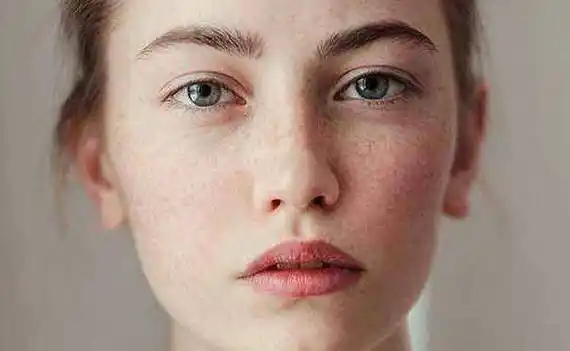 吃阿胶养血祛斑,滋润皮肤