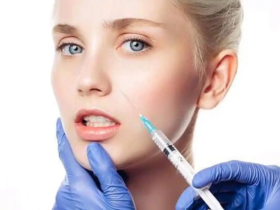 注射玻尿酸隆鼻