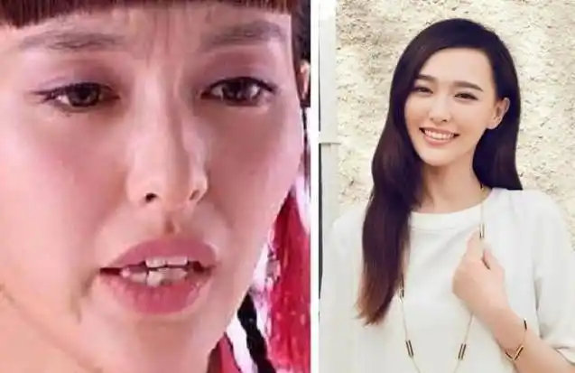 娱乐圈中那些整牙如换脸的明星看看前后对比照这差距有点大
