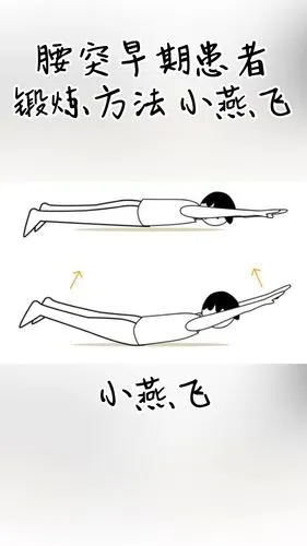 腰突早期患者锻炼锻炼小燕飞