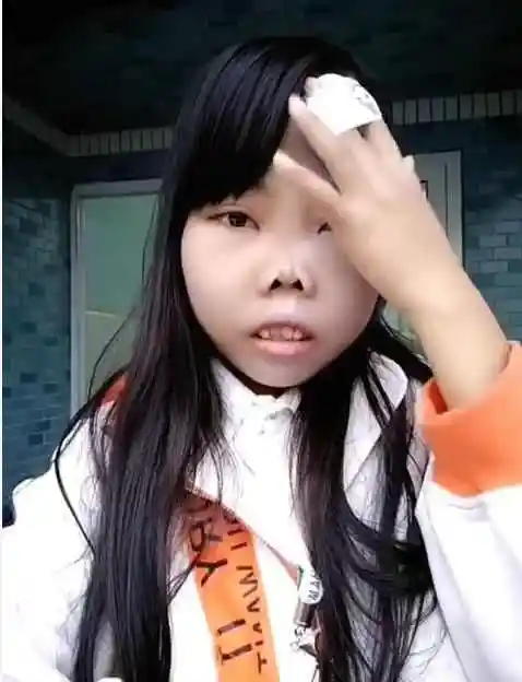 女版陈山来袭大饼脸没有鼻梁网友陈山的病没陈山的命