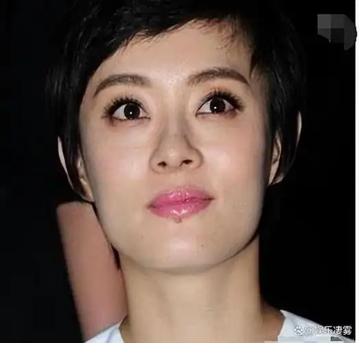 孙俪突然变好看,眼睛不凸也不发腮了,下巴的痣引热议,被指整容