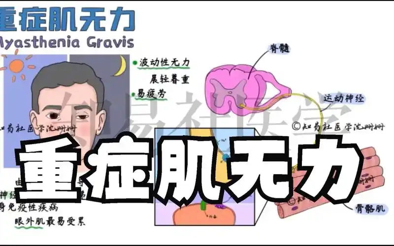 医学生笔记 重症肌无力