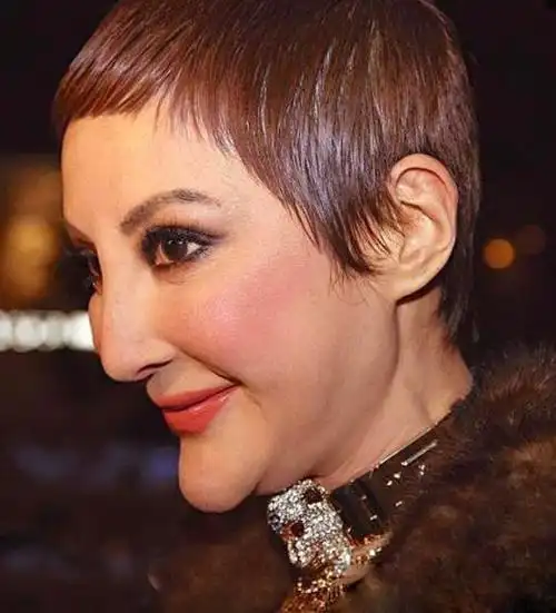 整容失败最吓人的六位明星第三位可以演外星人第六位演鬼片