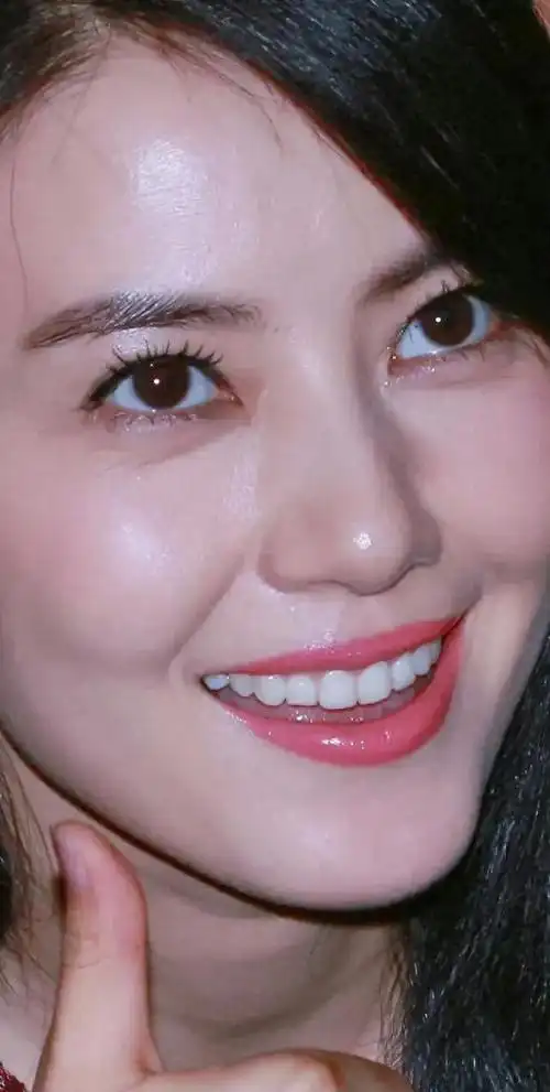 明星都爱烤瓷牙原因牙龈萎缩真的不能在修复?中医表示不认同!