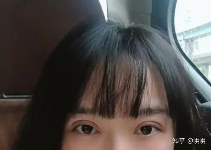 想知道有没有在苏州或者上海做双眼皮的?