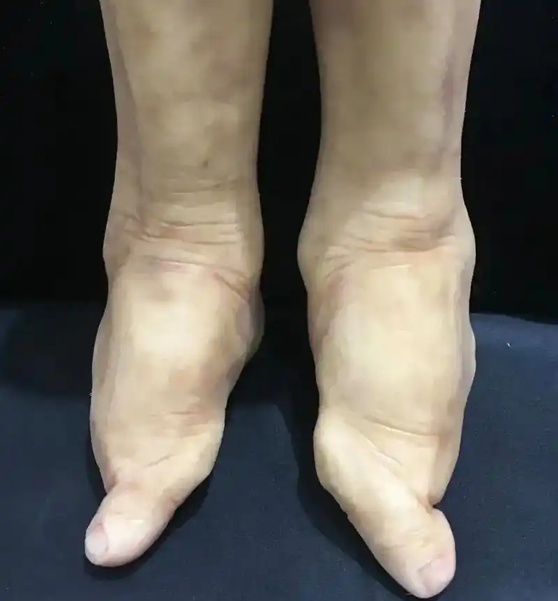 古代的三寸金莲,封建社会的畸形美很奇葩,不仅让人看着很恐怖,还感觉