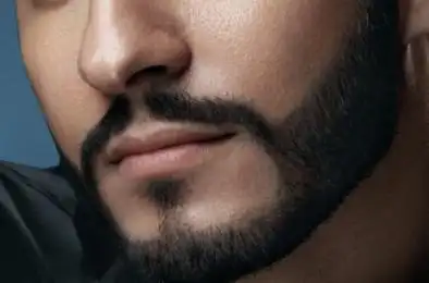 胡须种植多久可以刮胡子 兰州梦想整形王永铁种出沧桑魅惑