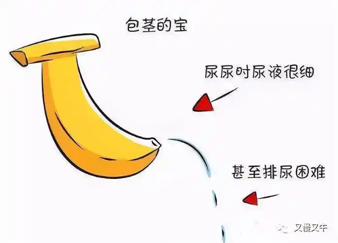 龟头是哪里包茎自翻步骤图片