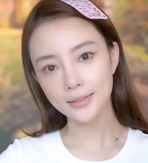 李小璐又重新做了欧式大双眼皮