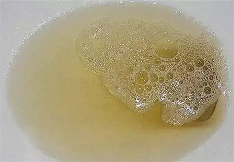 但小便的颜色也可随着喝水多少而使尿液有深有淡.