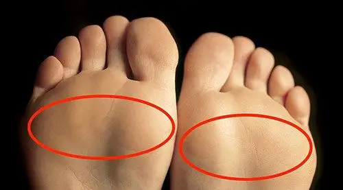 前脚掌痛是怎么回事?(跖痛症)_疼痛_疼痛相关疾病 - 好大夫在线