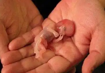 很多时候,她们都会选择尽早将胎儿打掉,这样伤身的可能性就小一点