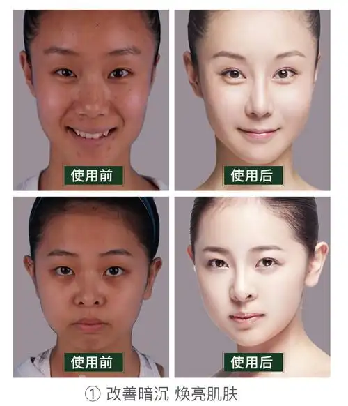 欧丽源美白原液淡斑补水保湿亮肤抗皱玻尿酸精华液化妆品批发