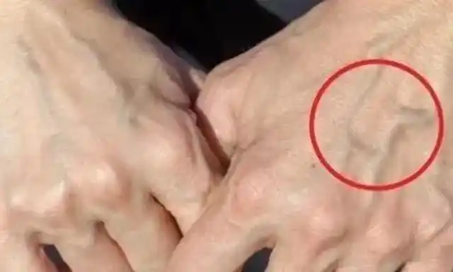 血管是身体中广泛分布的一种管道,血管的主要功能就是输送血液和营养