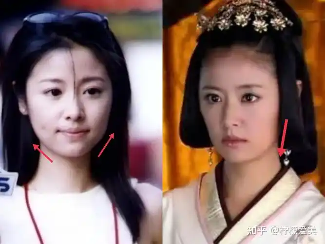 被林心如的脸吓cry,她怎么变这样了? - 知乎