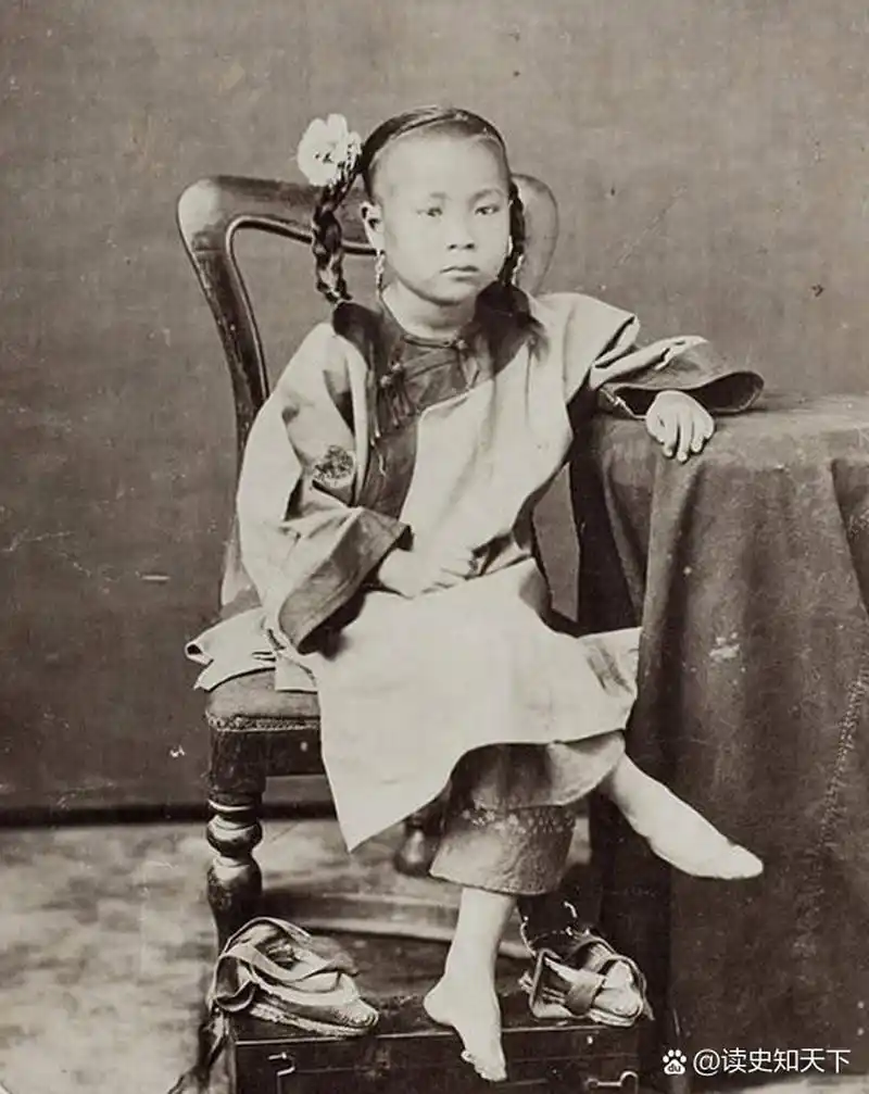 女性年仅五六岁的时候就开始裹脚,在成长的过程中双脚骨骼逐渐变形