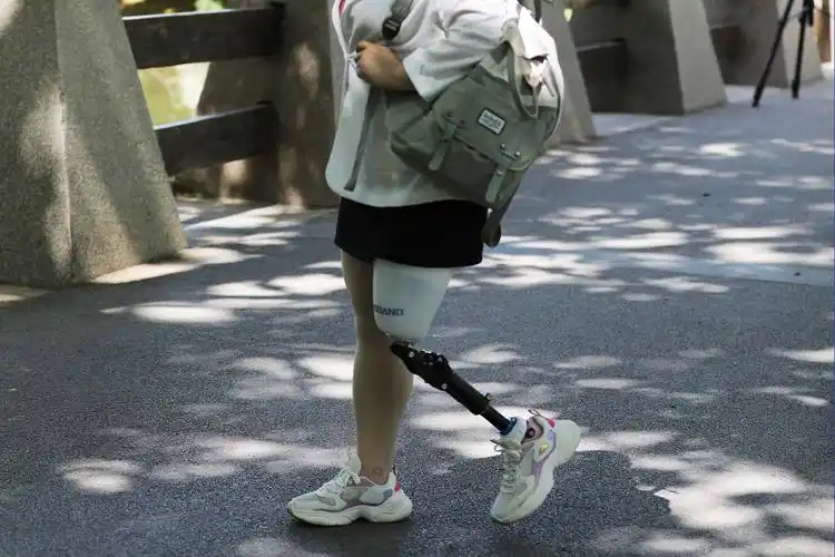 初装大腿假肢怎么应对磨合期