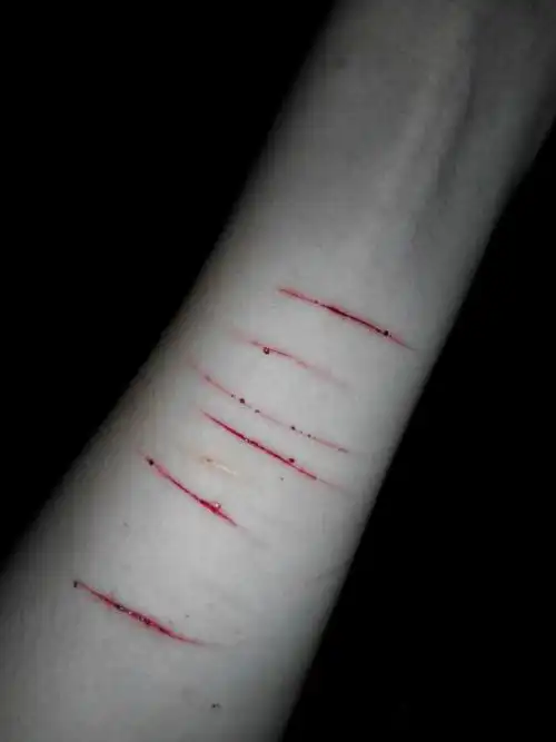 用于玩梗,特别是在未改版之前的厄加特原画,肚子上的伤疤是十分吓人的