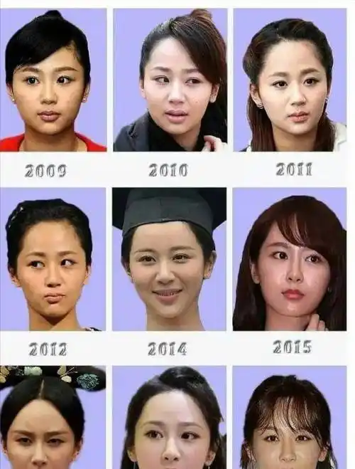 方脸变小v脸,拔牙能整容盘点那些"嘴硬"的整容明星_杨颖_杨紫_杨幂