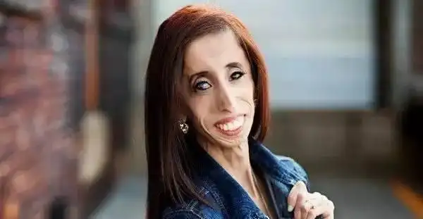 世界上最丑女子被众多帅哥追求 男生称:没追到是我一生的遗憾!