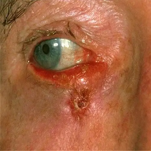 风顺堂区糖尿病医院_风顺堂区治疗糖尿病哪家医院好