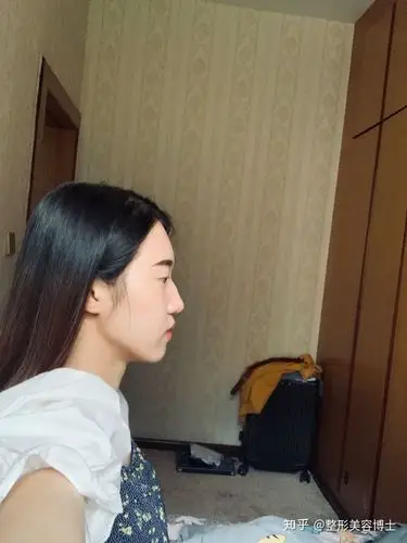 想知道我这样的侧脸为什么看起来怪怪的,应该怎样补救?