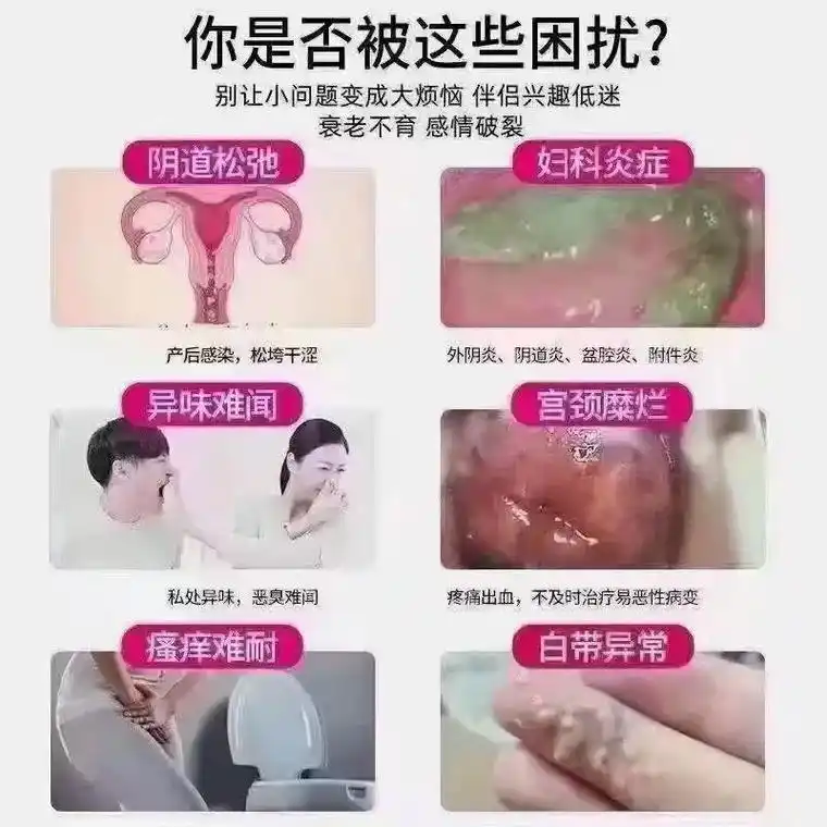 据国家统计,有50万女性患有妇科疾病,医院排队最长的就是妇科 - 抖音