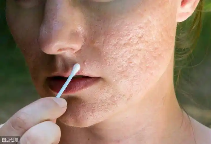 女人我最大毛孔女人毛孔粗大怎么办