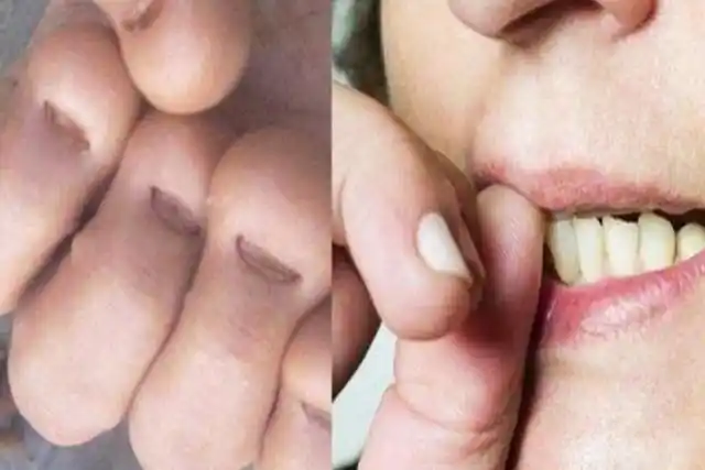 经常"咬指甲"的孩子,长大后会怎样?三种结局很残酷,趁早改