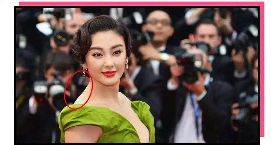 驼背骨盆前倾这些让你丑上天的问题怎么救