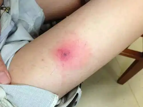 晚上睡觉时觉得痒,遂拍打,发现一蜘蛛样昆虫.