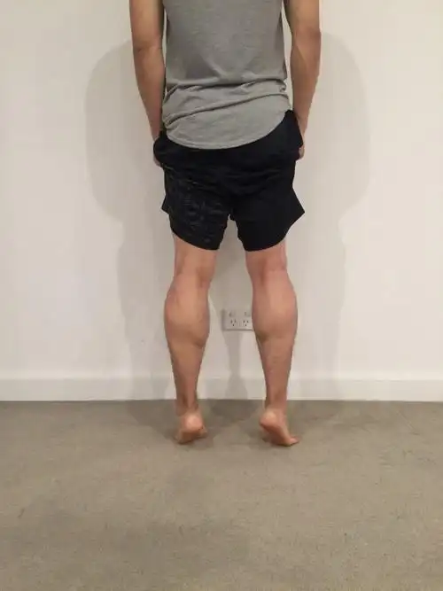 小腿粗主要有两个原因,一个是因为腿部脂肪堆积,另一个就是小腿肌肉