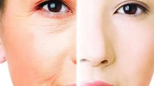 肌肤老化的表现及形态分析,医美治疗选择全解析