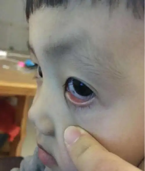 爸妈不用惊慌,这3原因惹得"祸"