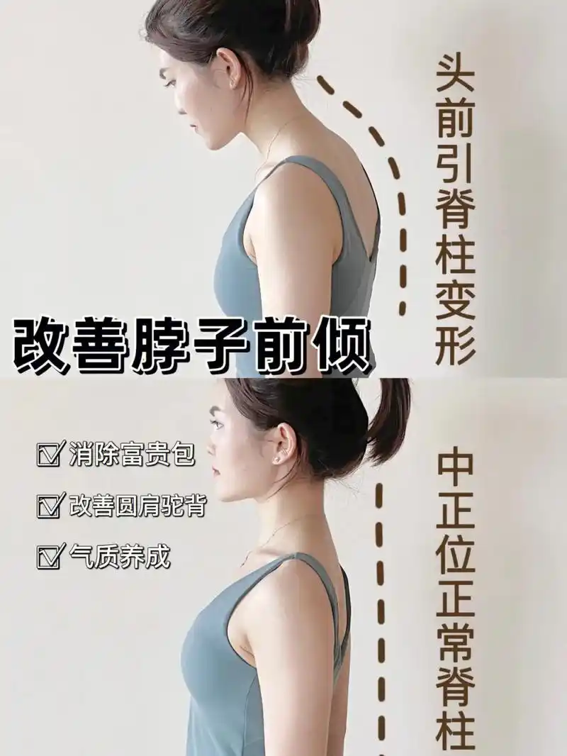 7个动作打造气质肩背73改善脖子前倾78.